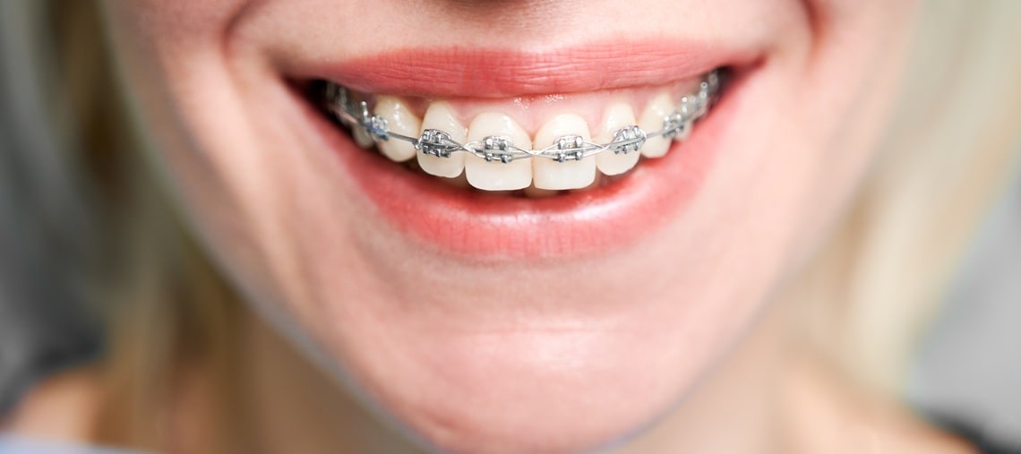 imagineArticol550174